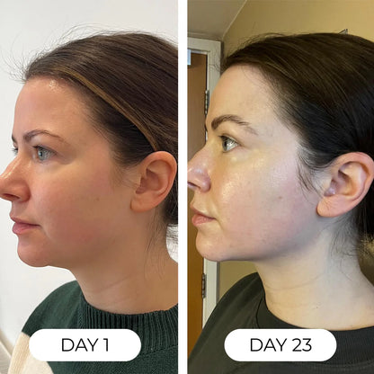 Verde™ 4-Herb Lymph Cleanse Drops